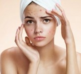 Ретиноїди в косметології: секрети застосування при проблемній шкірі
